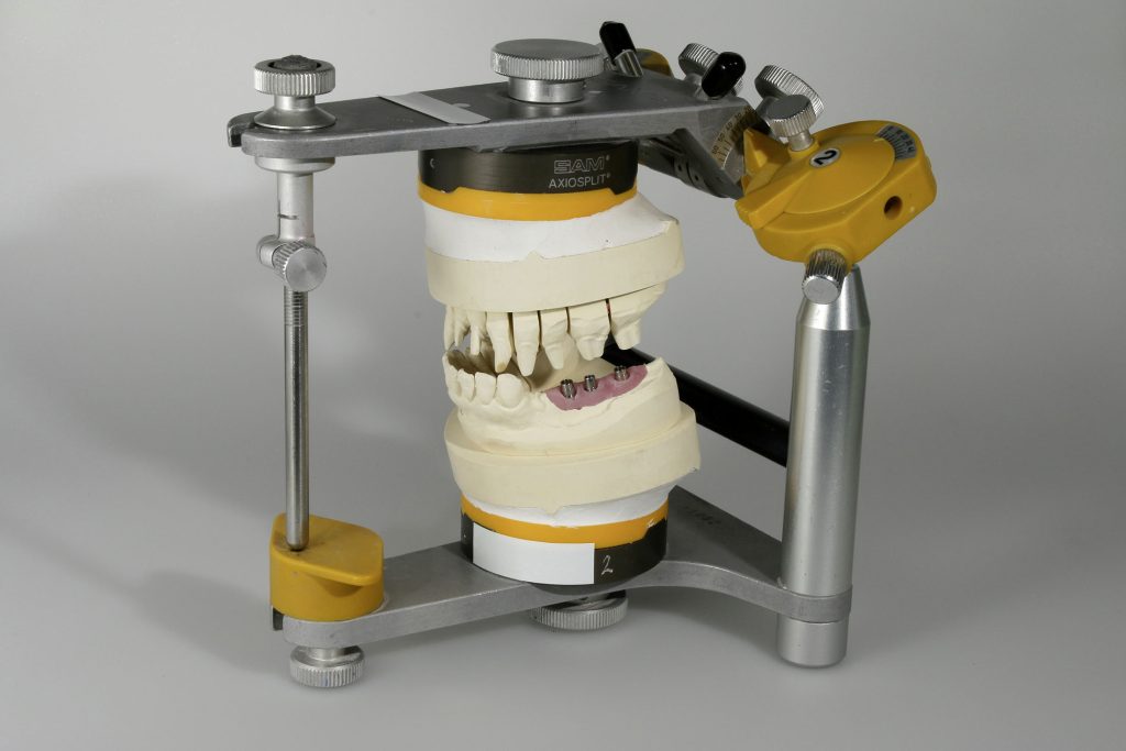 1_SAM_Artikulator_Implantarbeit