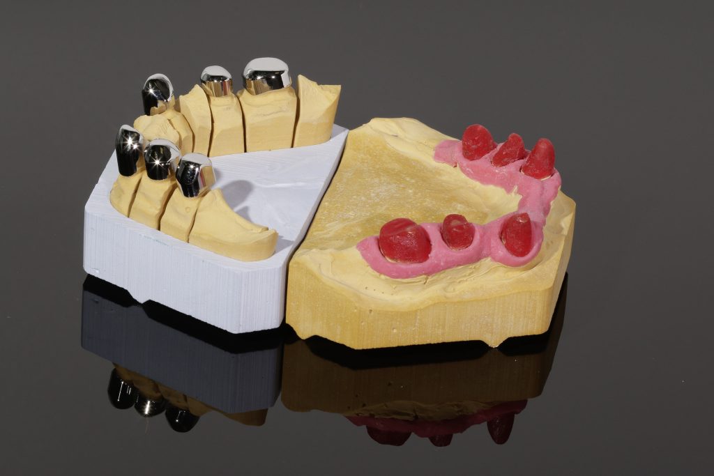 4_Prima_CC_88rteleskope_Zahnfleischmaske