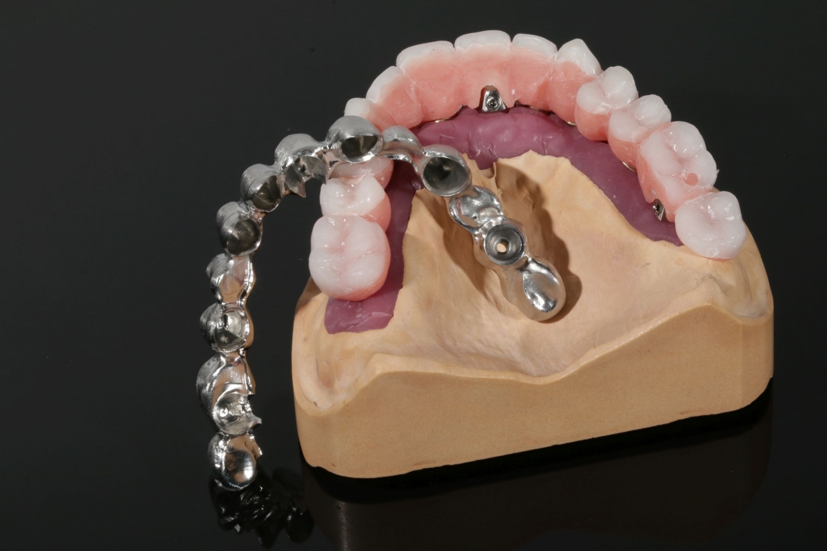 Bredent_Fast&Fixed__3281