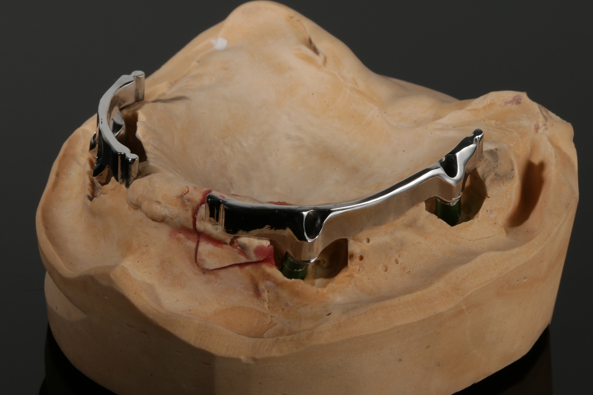 Sekund+ñr_Preci_9401