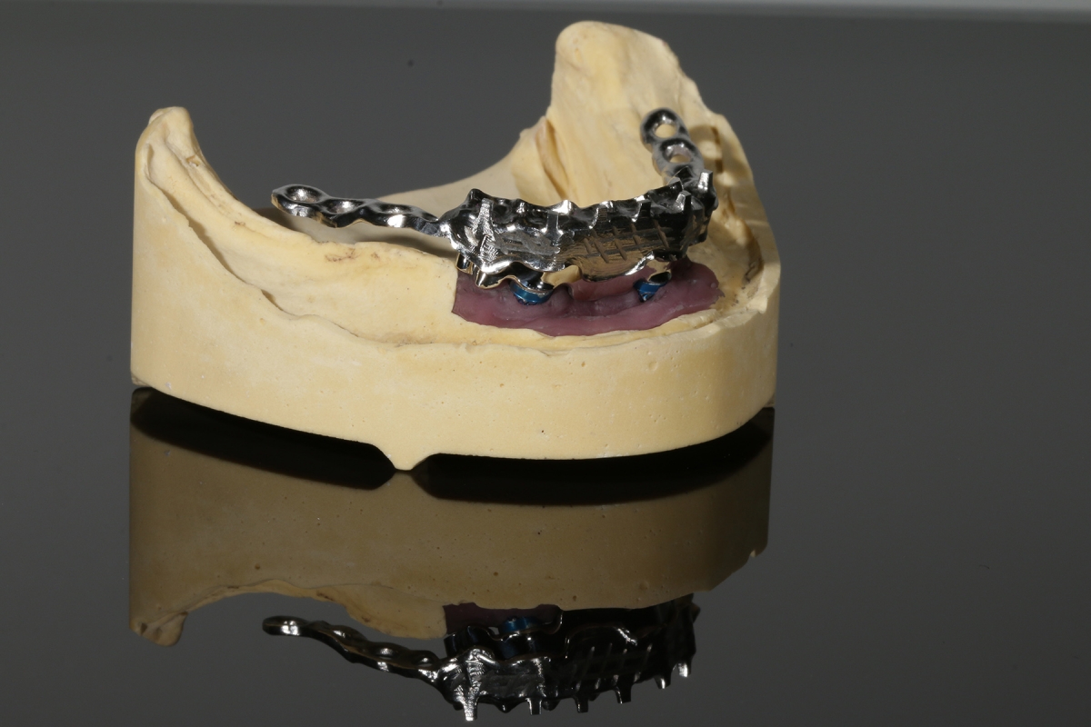 Sekund+ñr_Steg_Xive_3004