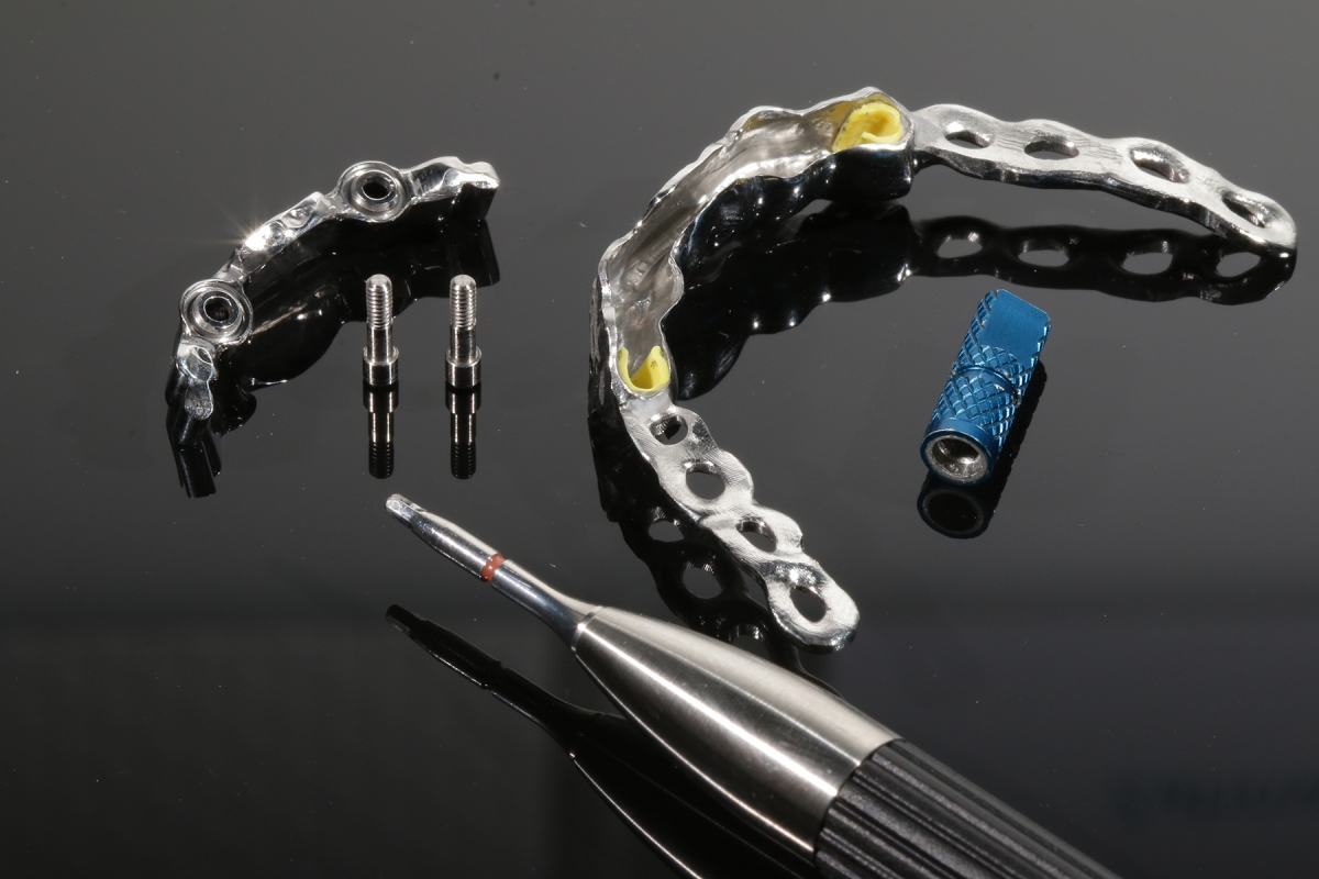 Sekund+ñr_Steg_Xive_3040