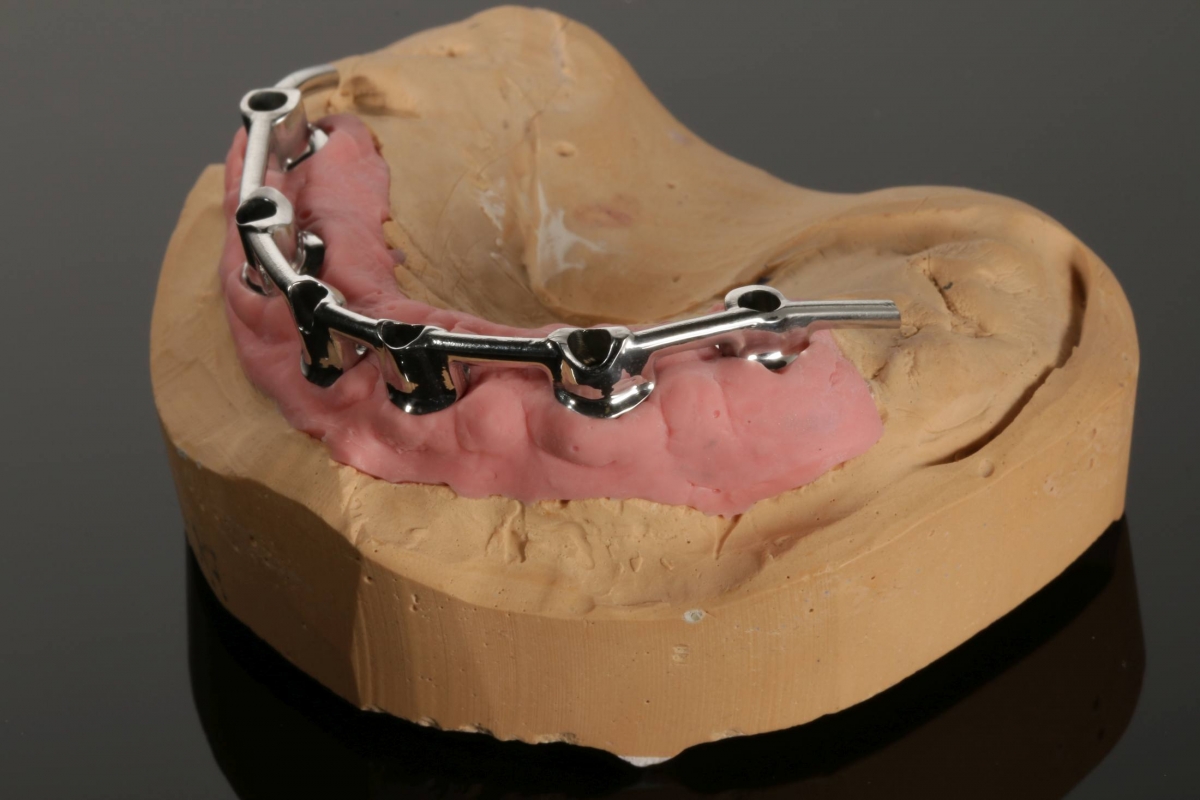 Straumann_Synocta_Dolder_micro_9736