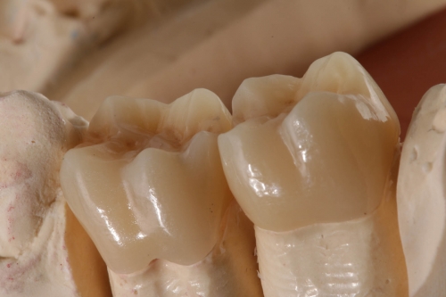 2_EMAX_monolithisch_finish_IMG_1172