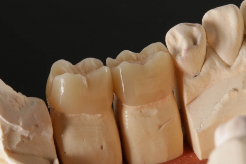 3_EMAX_monolithisch_finish_IMG_1173