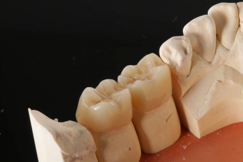 4_EMAX_monolithisch_finish_IMG_1182