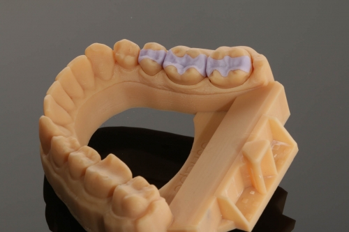 8_EMAX_Inlays_Inlays_9829