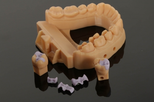 9_EMAX_Inlays_Inlays_9856