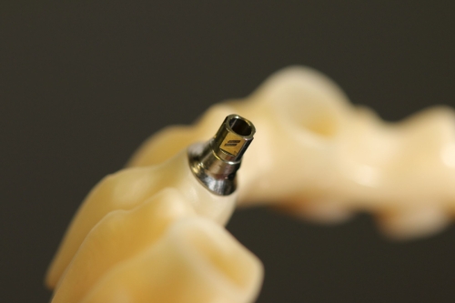 Straumann_Bonelevel_Preform_Abutment__0649