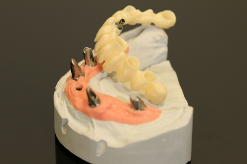 Straumann_Bonelevel_Preform_Abutment__0651