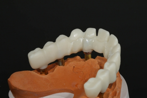 Teilungsgeschiebe_Zirkon_IMG_1538