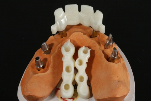 Teilungsgeschiebe_Zirkon_IMG_1547