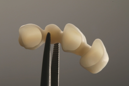 Zirkon_Gerüste_9753