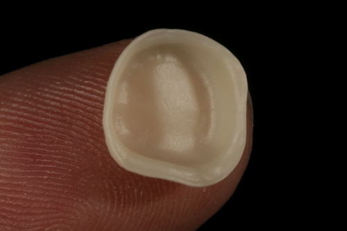 Zirkon_Gerüste_9774