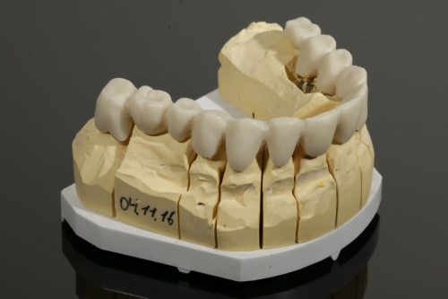 Zirkon_Pritidenta_3144