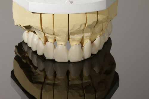 Zirkon_Pritidenta_3160-b