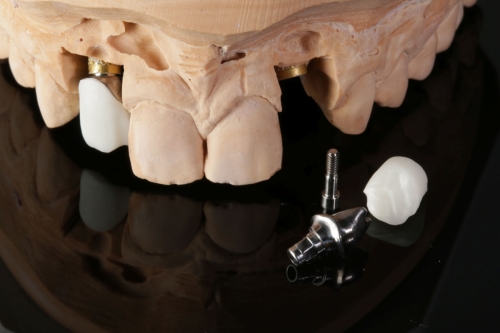 Zirkon_Zenostar_1626