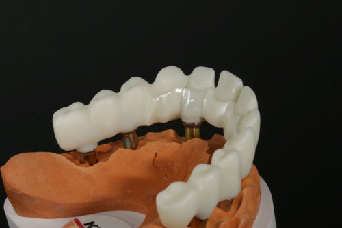 Zirkon_Zenostar_Teilungsgeschiebe_1539