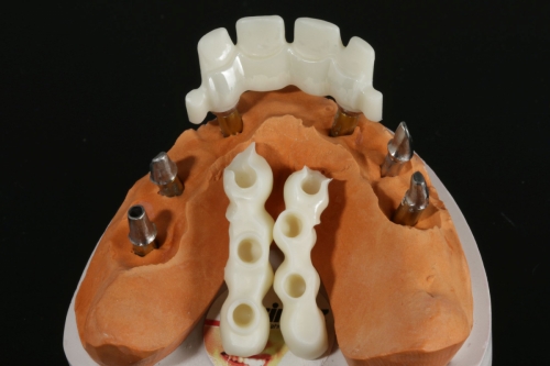 Zirkon_Zenostar_Teilungsgeschiebe_1547