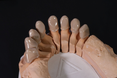 Zirkon_Zenostar_Teleskope_1924