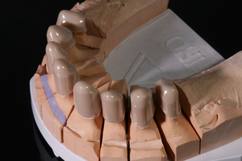 Zirkon_Zenostar_Teleskope_1925